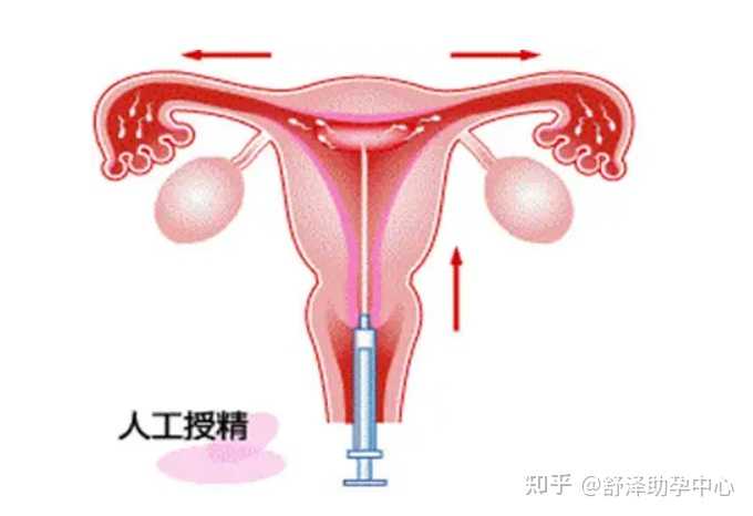 北京协和医院借卵生男孩费用预估6-8万元?