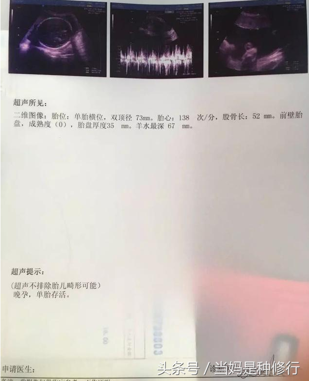 郑州代孕那儿最权威_B超图像已经显示男宝，附这次症状